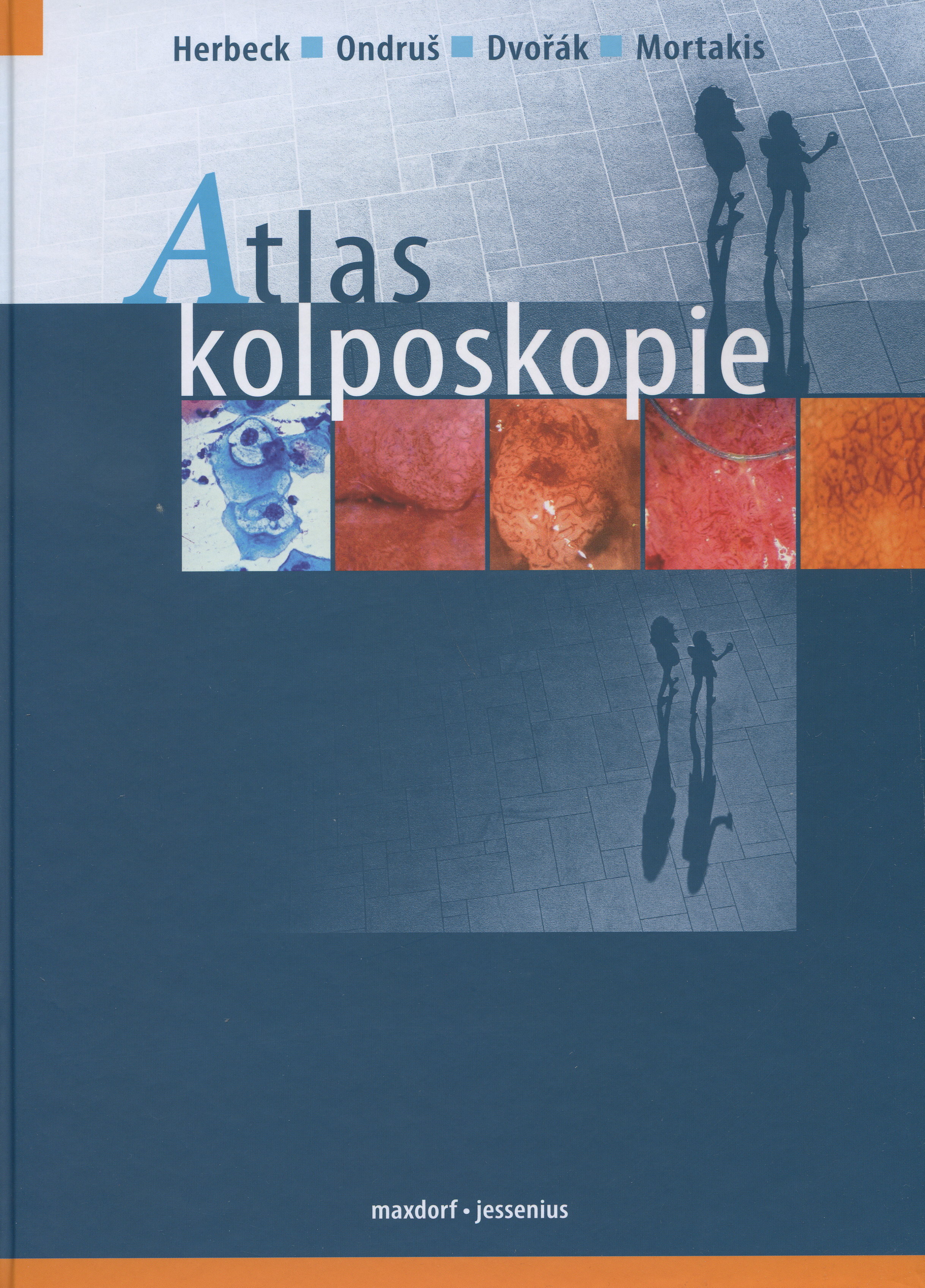 Atlas kolposkopie